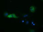 SULT2A1 Antibody in Immunocytochemistry (ICC/IF)