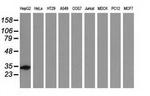 SULT2A1 Antibody in Western Blot (WB)