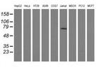 ARHGAP25 Antibody in Western Blot (WB)