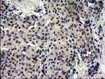 GGPS1 Antibody in Immunohistochemistry (Paraffin) (IHC (P))