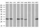 GGPS1 Antibody in Western Blot (WB)