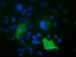 ARHGAP25 Antibody in Immunocytochemistry (ICC/IF)