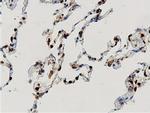 ARHGAP25 Antibody in Immunohistochemistry (Paraffin) (IHC (P))