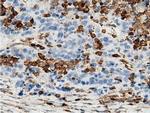 ARHGAP25 Antibody in Immunohistochemistry (Paraffin) (IHC (P))