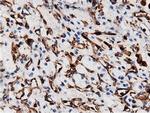 ARHGAP25 Antibody in Immunohistochemistry (Paraffin) (IHC (P))