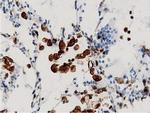 ARHGAP25 Antibody in Immunohistochemistry (Paraffin) (IHC (P))