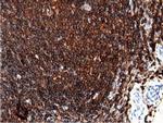 ARHGAP25 Antibody in Immunohistochemistry (Paraffin) (IHC (P))