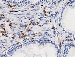 ARHGAP25 Antibody in Immunohistochemistry (Paraffin) (IHC (P))