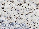 ARHGAP25 Antibody in Immunohistochemistry (Paraffin) (IHC (P))