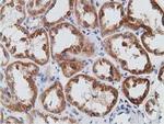 PECR Antibody in Immunohistochemistry (Paraffin) (IHC (P))