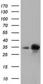 PECR Antibody in Western Blot (WB)