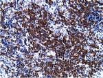 PIK3AP1 Antibody in Immunohistochemistry (Paraffin) (IHC (P))