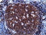 PIK3AP1 Antibody in Immunohistochemistry (Paraffin) (IHC (P))