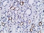 PIK3AP1 Antibody in Immunohistochemistry (Paraffin) (IHC (P))