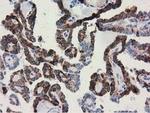 Adenylate Kinase 3 Antibody in Immunohistochemistry (Paraffin) (IHC (P))