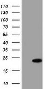 ADI1 Antibody in Western Blot (WB)