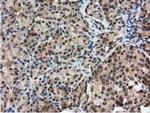 RNH1 Antibody in Immunohistochemistry (Paraffin) (IHC (P))