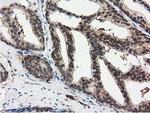 RNH1 Antibody in Immunohistochemistry (Paraffin) (IHC (P))