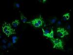 PYCR2 Antibody in Immunocytochemistry (ICC/IF)