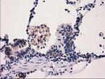 PYCR2 Antibody in Immunohistochemistry (Paraffin) (IHC (P))