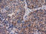 PYCR2 Antibody in Immunohistochemistry (Paraffin) (IHC (P))