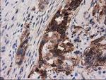 PYCR2 Antibody in Immunohistochemistry (Paraffin) (IHC (P))