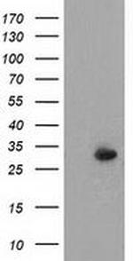 PYCR2 Antibody in Western Blot (WB)