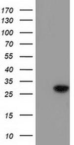 BIN3 Antibody in Western Blot (WB)