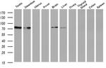 SAMHD1 Antibody in Western Blot (WB)