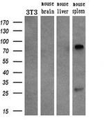 SAMHD1 Antibody in Western Blot (WB)