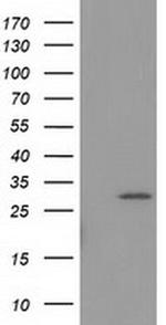 BIN3 Antibody in Western Blot (WB)