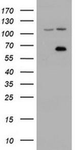 ZIM2 Antibody in Western Blot (WB)