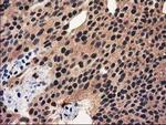 RNH1 Antibody in Immunohistochemistry (Paraffin) (IHC (P))