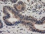 RNH1 Antibody in Immunohistochemistry (Paraffin) (IHC (P))