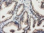 RNH1 Antibody in Immunohistochemistry (Paraffin) (IHC (P))