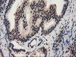 RNH1 Antibody in Immunohistochemistry (Paraffin) (IHC (P))