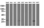 SPR Antibody in Western Blot (WB)