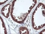 RABL2A Antibody in Immunohistochemistry (Paraffin) (IHC (P))