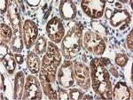 HDAC6 Antibody in Immunohistochemistry (Paraffin) (IHC (P))