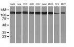 HDAC6 Antibody in Western Blot (WB)