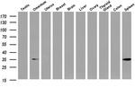 Annexin A3 Antibody in Western Blot (WB)