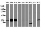 Annexin A3 Antibody in Western Blot (WB)