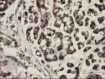 CLPP Antibody in Immunohistochemistry (Paraffin) (IHC (P))