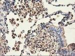 CLPP Antibody in Immunohistochemistry (Paraffin) (IHC (P))