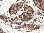 CLPP Antibody in Immunohistochemistry (Paraffin) (IHC (P))