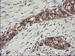 CLPP Antibody in Immunohistochemistry (Paraffin) (IHC (P))