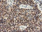 CLPP Antibody in Immunohistochemistry (Paraffin) (IHC (P))