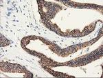 CLPP Antibody in Immunohistochemistry (Paraffin) (IHC (P))