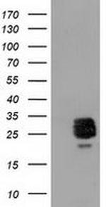 CLPP Antibody in Western Blot (WB)