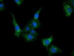 CLPP Antibody in Immunocytochemistry (ICC/IF)